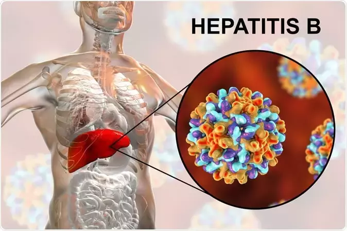 viem-gan-b-do-virus-hepatitis-b-gay-ra.webp